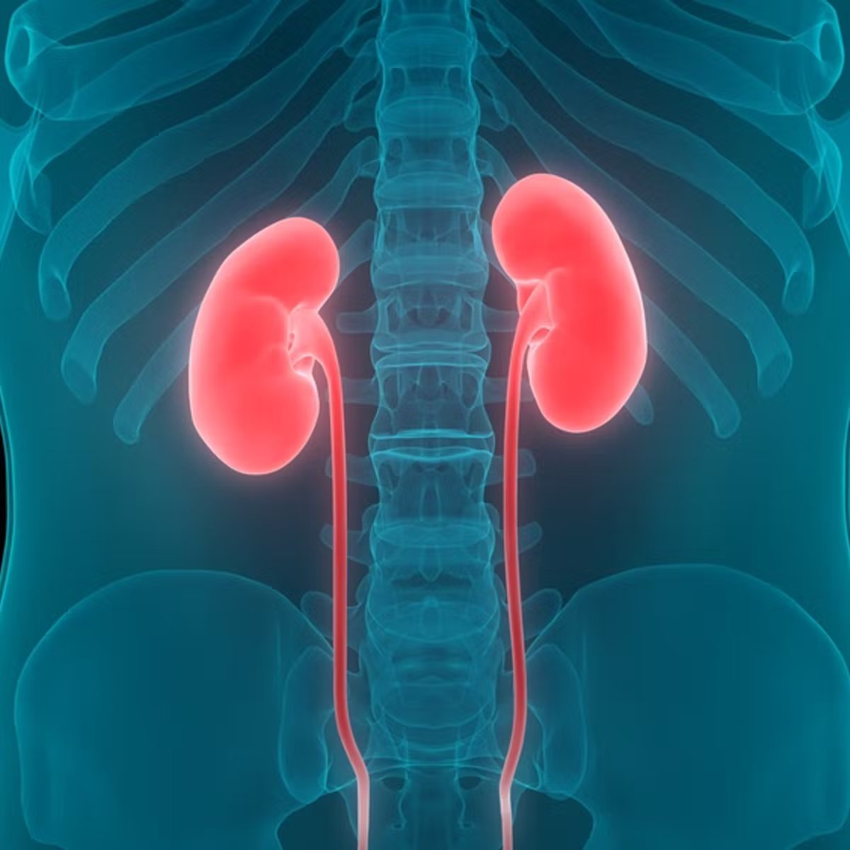 Kidney Stones - Highness Urology Clinic - Dubai